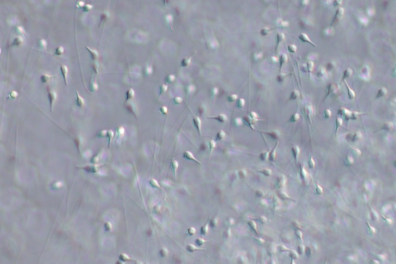 Spermatozoïdes de la Moule (Mytilus edulis) x125